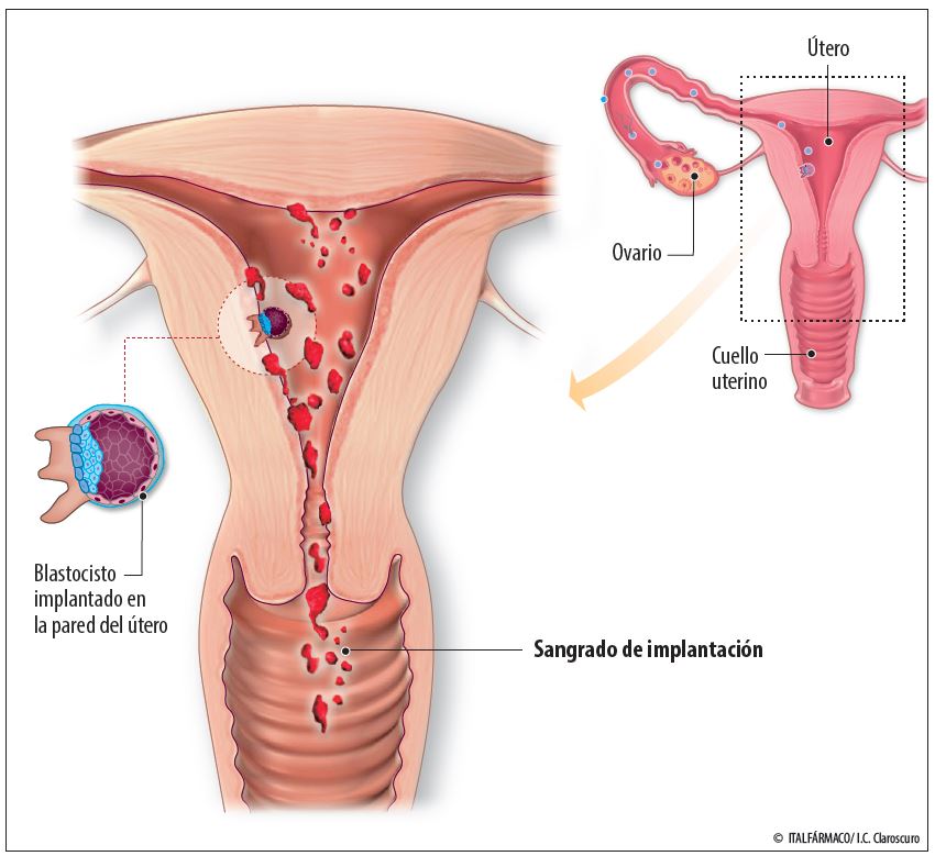 Implantación del embrión Maternar