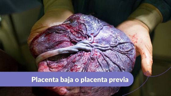Placenta baja Maternar