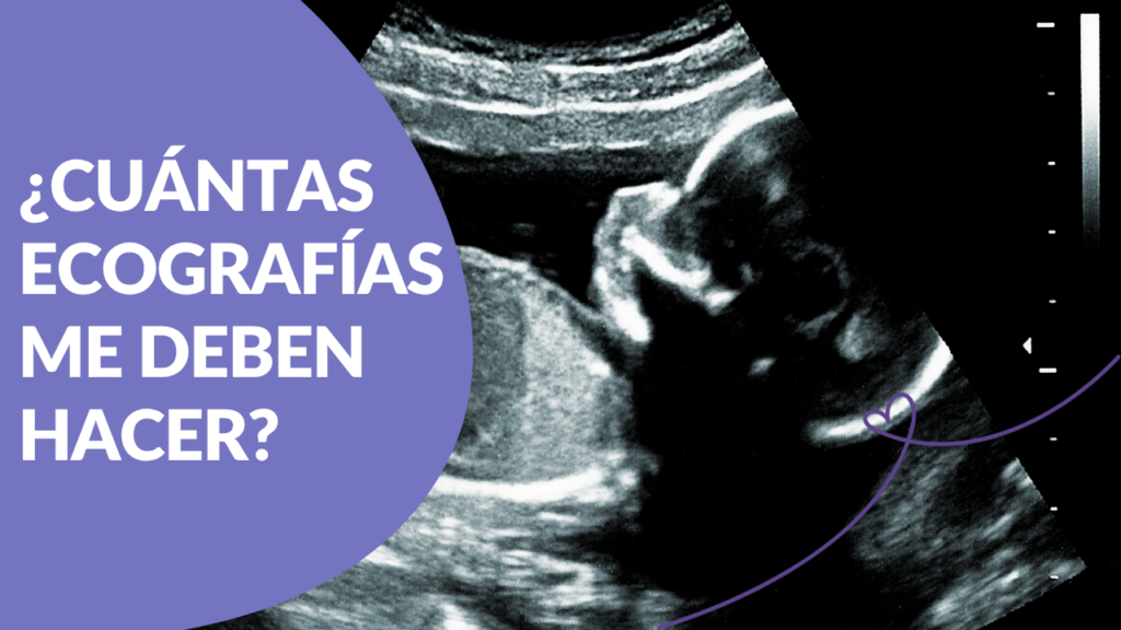 Ecografías seguras
