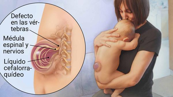 SALUD  Ácido fólico en el embarazo previene defectos congénitos en el  nacimiento: SSM